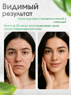 Маска-пленка SADOER Алое Вера для удаления черных точек 100 г.